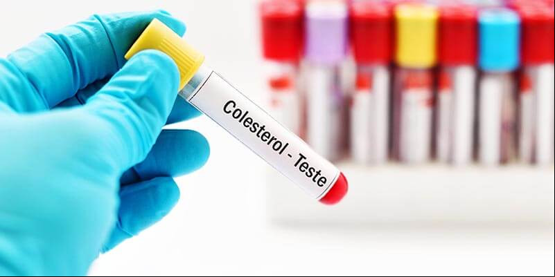 Diagnóstico de colesterol requer analises clinicas periódicas - (Reprodução/Unicardio)