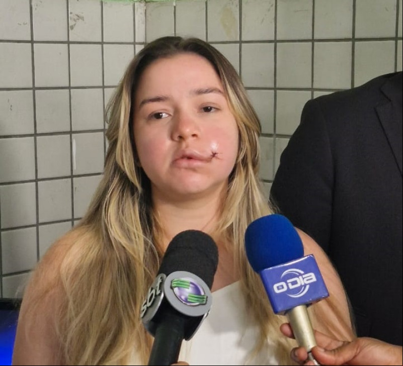 Mariana Lopes, modelo que acusa síndico de condomínio em Teresina. - (Anderson Araújo / O DIA)