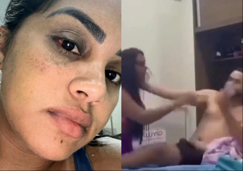Ex-mulher de Chicão dos Teclados filma agressão e denuncia namorado nas redes sociais - (Reprodução/Redes Sociais)