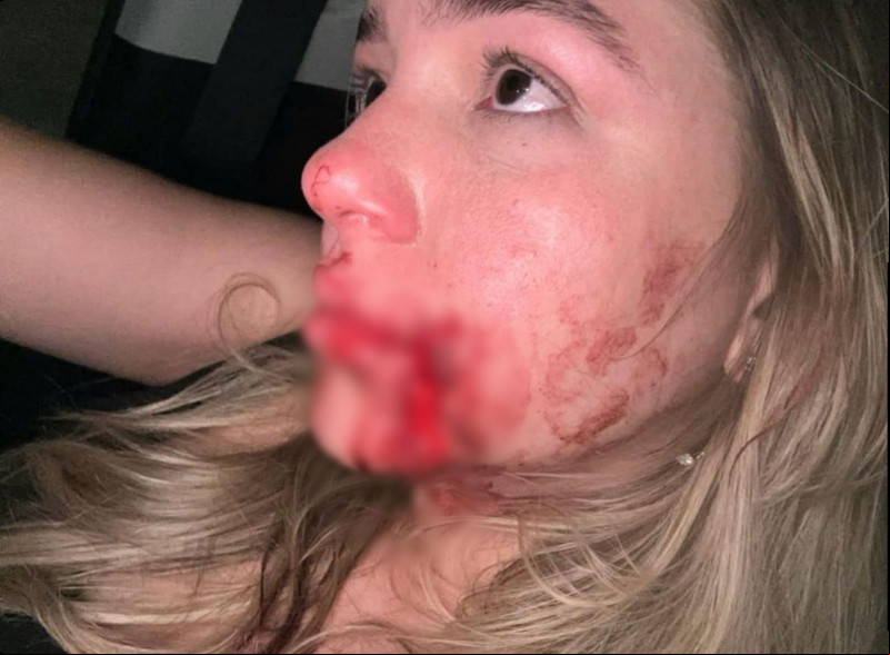 Mariana Lopes de Meneses acusa o síndico do condomínio de agressão - (Arquivo Pessoal)