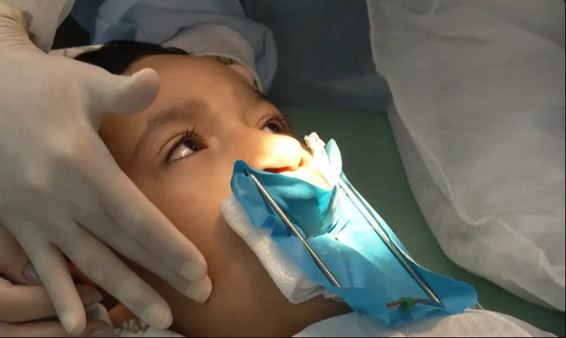 SUS ará a oferecer cirurgia reconstrutiva de lábio leporino - (Reprodução/TV Brasil )